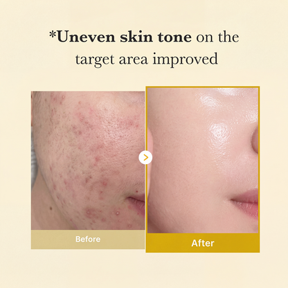 Wake Up To Clearer Skin With KOJIC ACID TURMERIC WRAPPING MASK